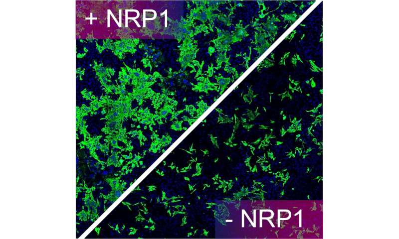 Neuropilin-1 drives SARS-CoV-2 infectivity, finds breakthrough study