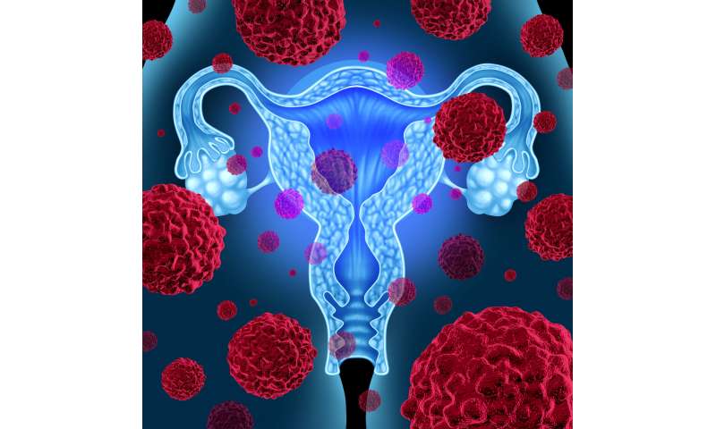 Cervical cancer: New radiotherapy technique prolongs survival thumbnail