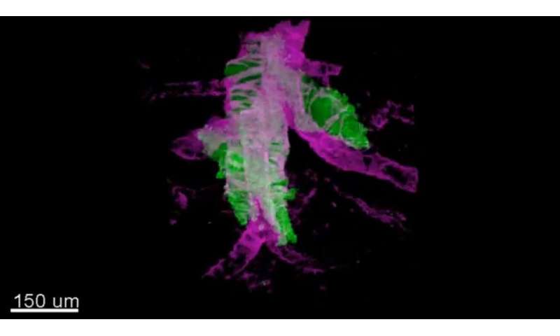 Scientists capture 3-D images of tumors in subcellular resolution