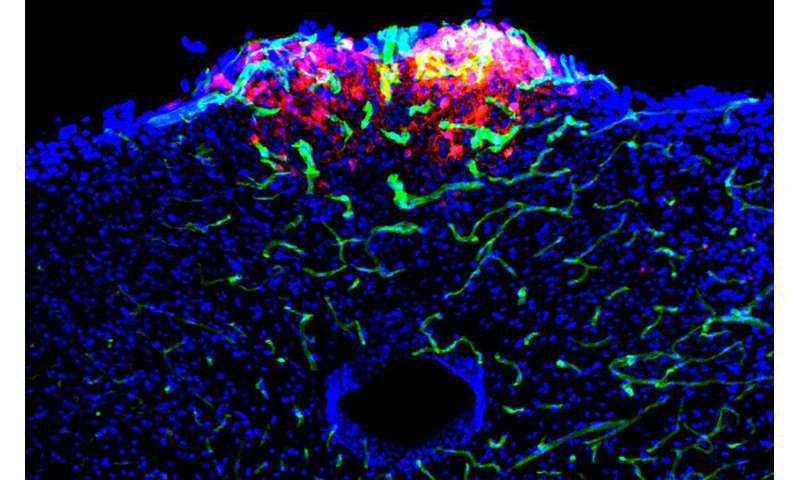 Study explores neurons that control nausea-like responses thumbnail