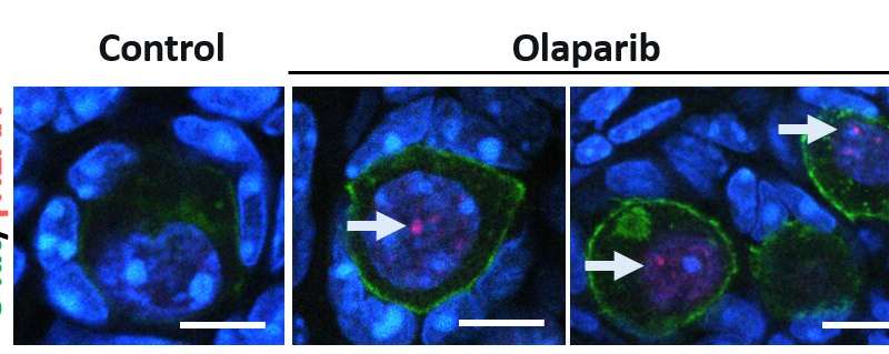 Breast cancer drug, olaparib, depletes store of immature eggs in mouse ovaries