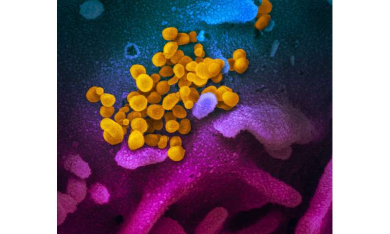 New coronavirus stable for hours on surfaces