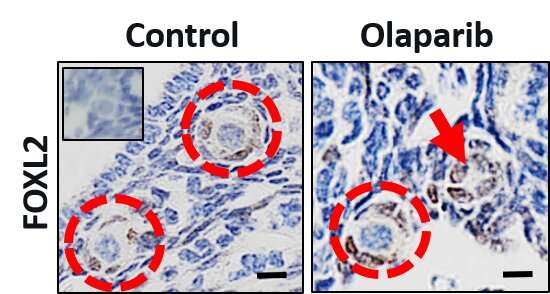 Breast cancer drug, olaparib, depletes store of immature eggs in mouse ovaries