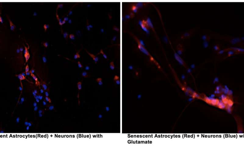 Buck researchers discover how cellular senescence leads to neurodegeneration