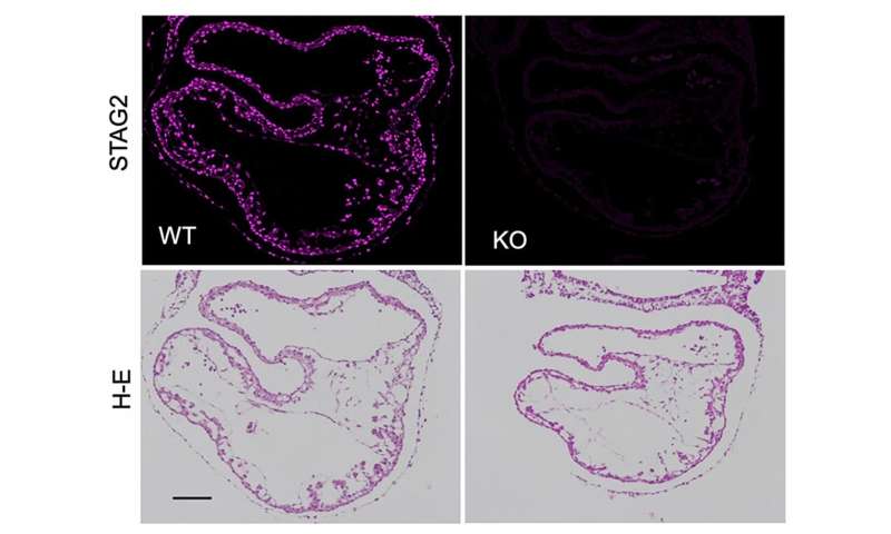 CNIO and CNIC find clues to clarify why cohesine has a role in cancer and cardiac development