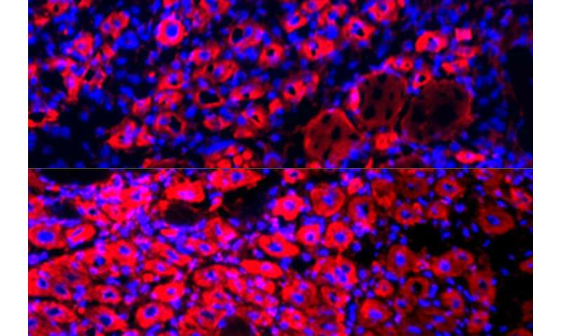 Diluting blood plasma rejuvenates tissue, reverses aging in mice