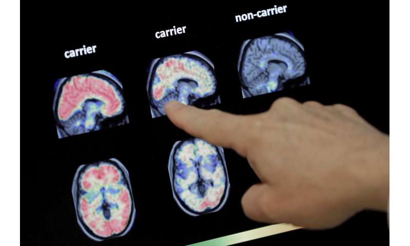 Drugs fail to slow decline in inherited Alzheimer's disease