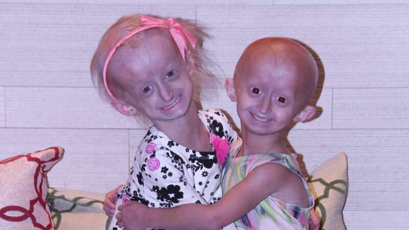 Engineered living-cell blood vessel provides new insights to progeria