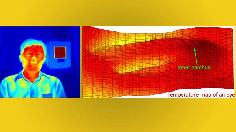 Full-face readings can optimize fever screening with infrared thermographs