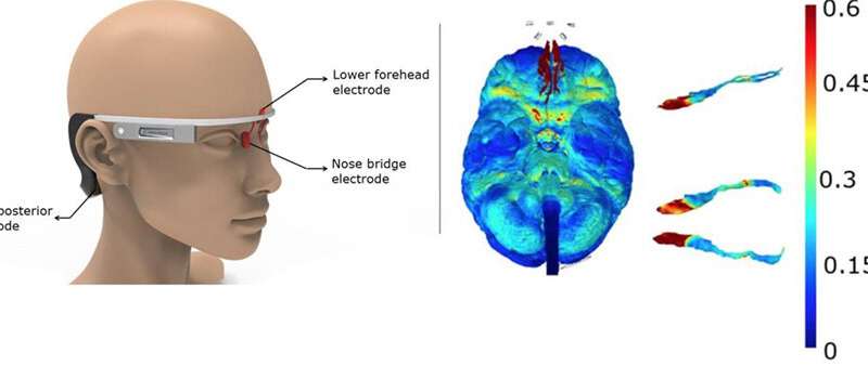 Stimolatore elettrico simile al vetro di Google per eliminare il morbo di Alzheimer
