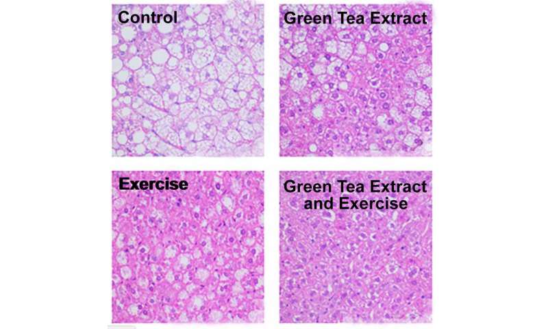 Green tea extract combined with exercise reduces fatty liver disease in mice