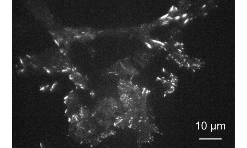 Higher-resolution imaging of living, moving cells using plasmonic metasurfaces