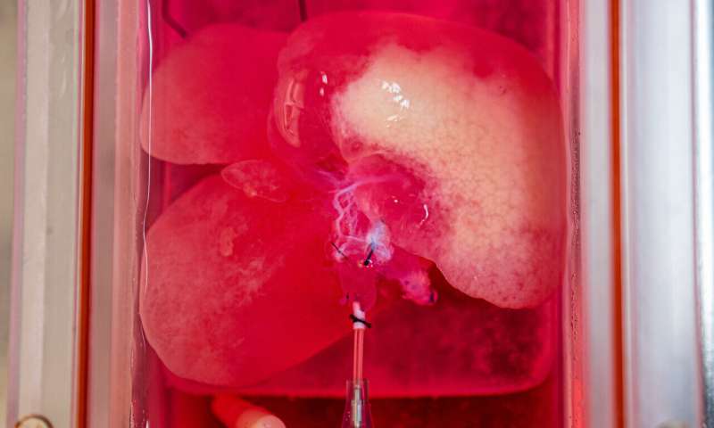 Lab-grown miniature human livers successfully transplanted in rats