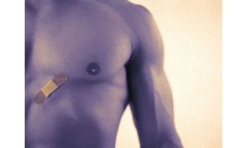 Many male breast cancers diagnosed late, and delays can be lethal