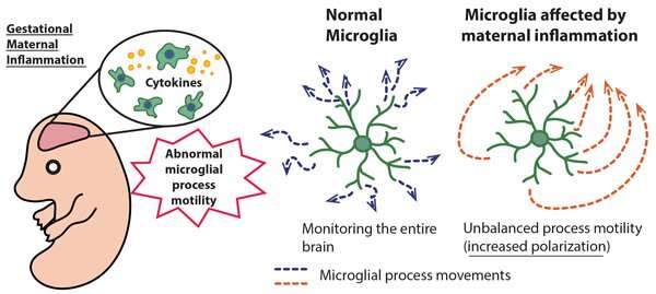 Maternal immune activation induces sustained changes in fetal microglia motility