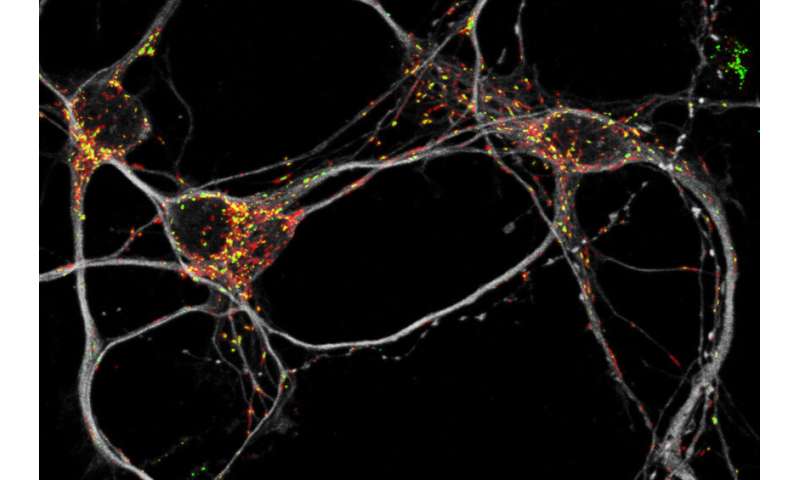 Nerve cells with energy saving program