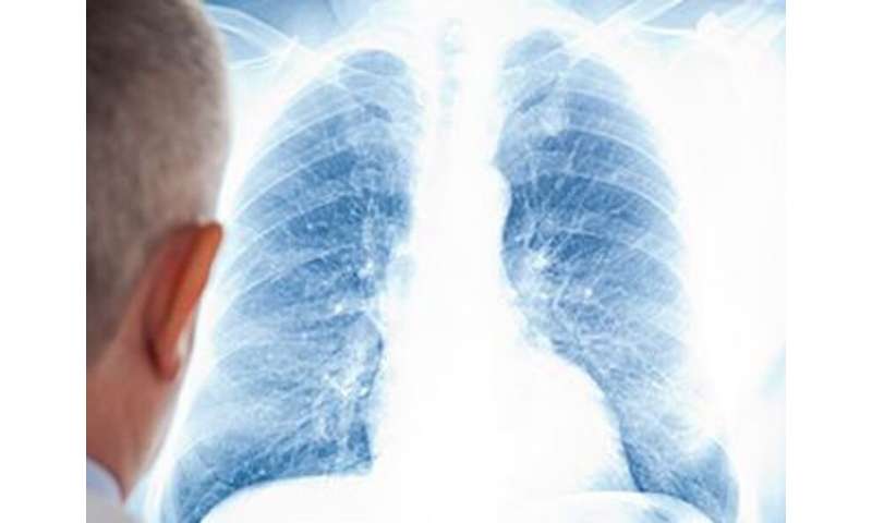 大流行的封闭，恐惧让患者免受肺癌筛查