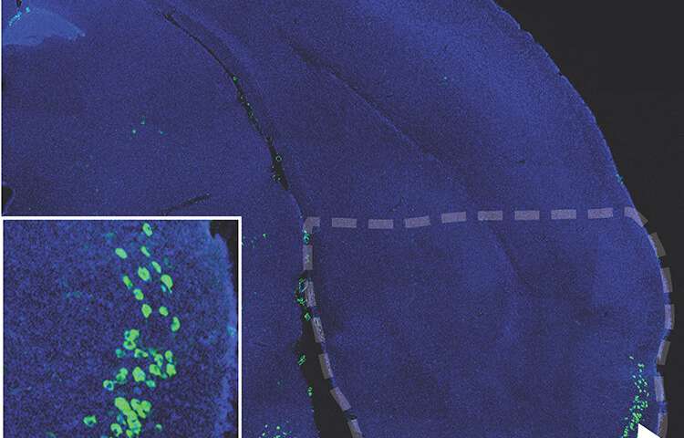 Plasticity may make neurons vulnerable to Alzheimer's disease