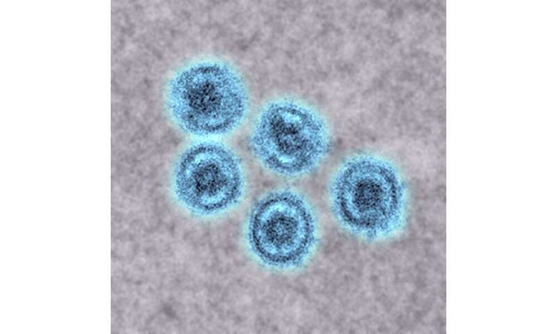 Reston virus
