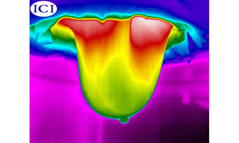 Using Infrared Cameras to Detect Early Stage Breast Cancer