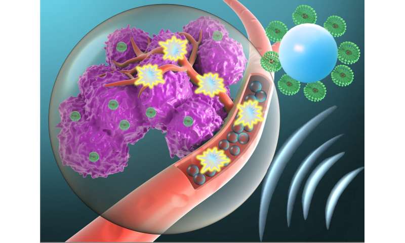 Gerichte microbellen gebruiken om giftige kankermedicijnen toe te dienen