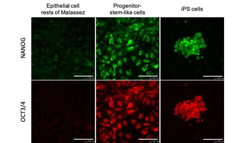 Direct reprogramming of oral epithelial cells into mesenchymal-like cells