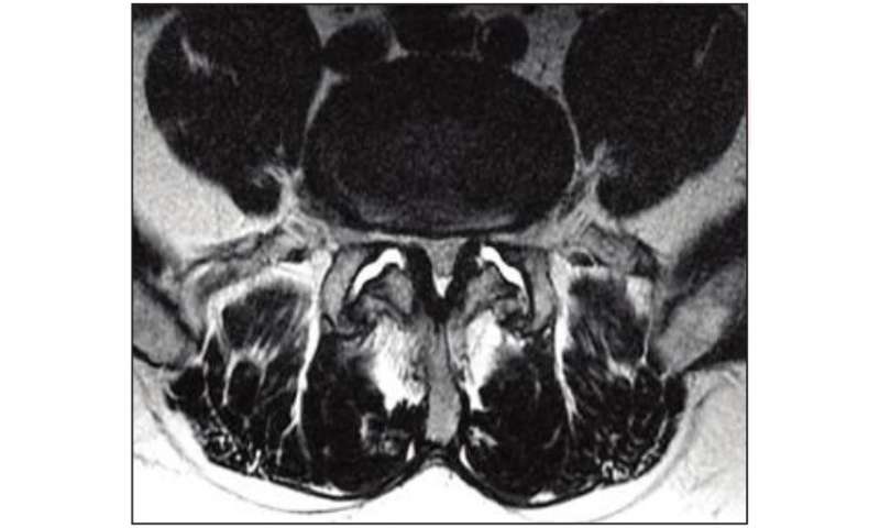 Impact of patient-reported symptom information on lumbar spine MRI Interpretation
