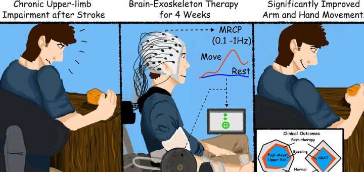 Tapping the brain to boost stroke rehabilitation