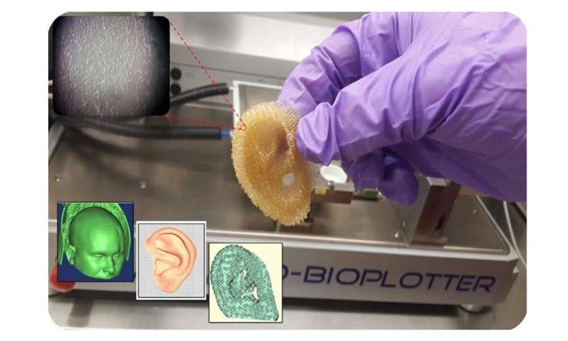 3D印刷器官可以通过解决移植短缺来拯救生命