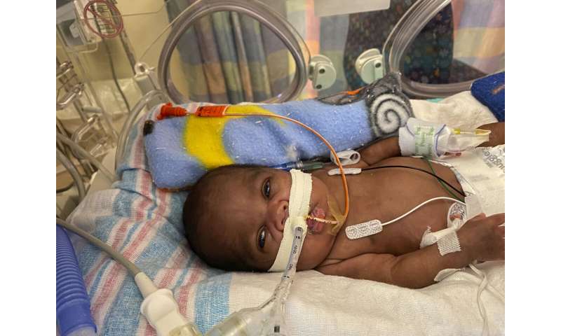 Niño de Alabama nombrado bebé más prematuro del mundo en sobrevivir