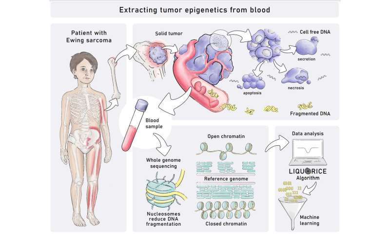 Blood test detects childhood tumors based on their epigenetic profiles