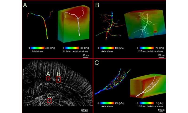 Brain injury computer models map brain blood vessels in highest resolution yet