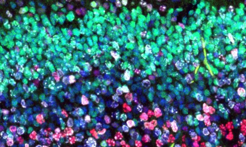 Defective gene slows down brain cells