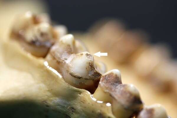 Fossil tooth fractures and microscopic detail of enamel offer new clues about human diet and evolution