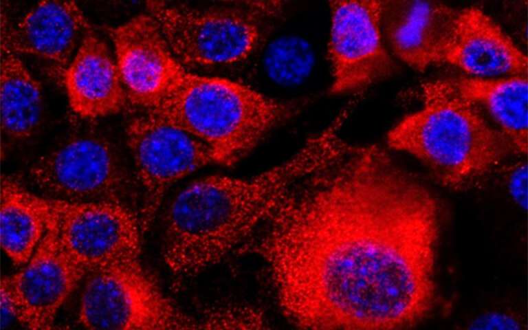 How pancreatic cancer cells dodge drug treatments