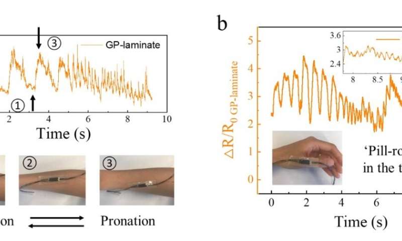 Is it possible to detect and assess neuromuscular functions via wearable, soft yet durable strain sensors?