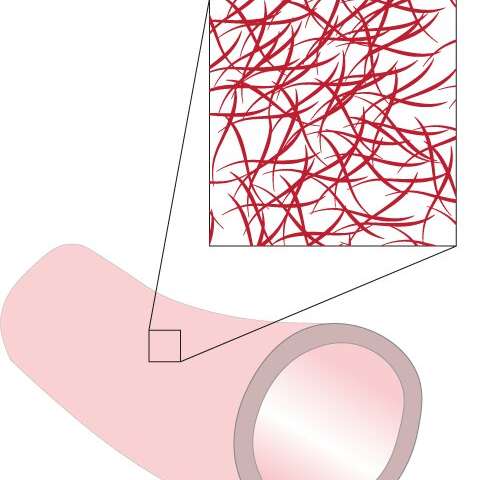 关于肾透析的合成血管中组织生长的新洞察