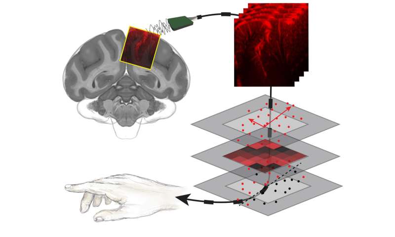Reading minds with ultrasound: A less-invasive technique to decode the brain's intentions