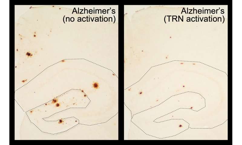 Restoring normal sleep reduces amyloid-beta accumulation in mouse model of Alzheimer's disease