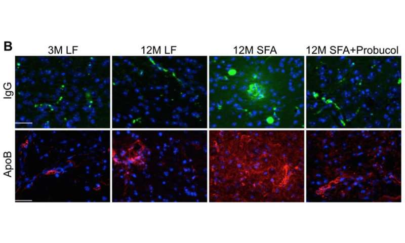 La scoperta dei topi mutanti WA trova la probabile causa del morbo di Alzheimer