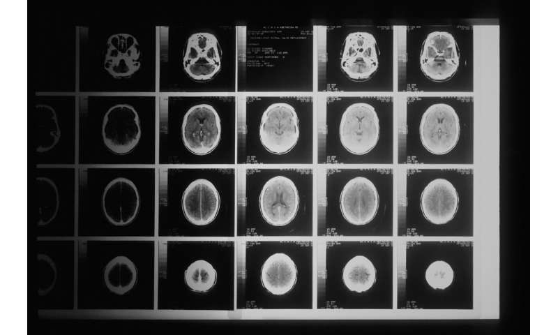 brain imaging