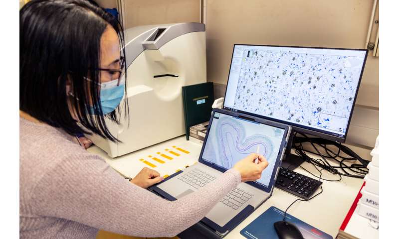 细胞通过细胞,科学家们建立一个高分辨率的地图阿尔茨海默氏症的大脑变化