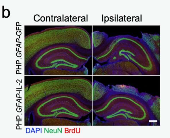 Harnessing the immune system to treat traumatic brain injury in mice