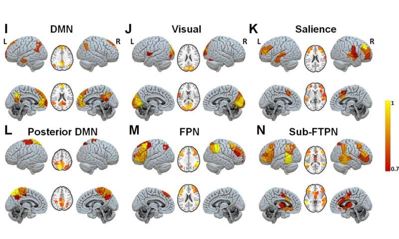 HBP study explores mechanisms that underlie disorders of consciousness