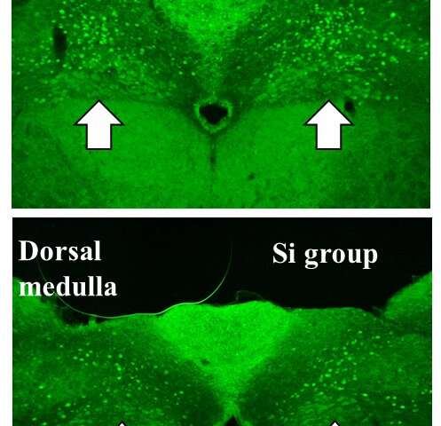 硅基剂产生的氢能减轻溃疡性结肠炎小鼠模型的炎症反应