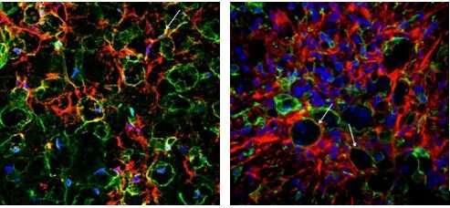 Kazan Federal University scientists studying extracellular matrix and microglial cells in the injured spinal cord to dev