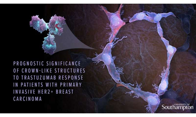 Scientists discover a potential new marker to personalised therapy for breast cancer