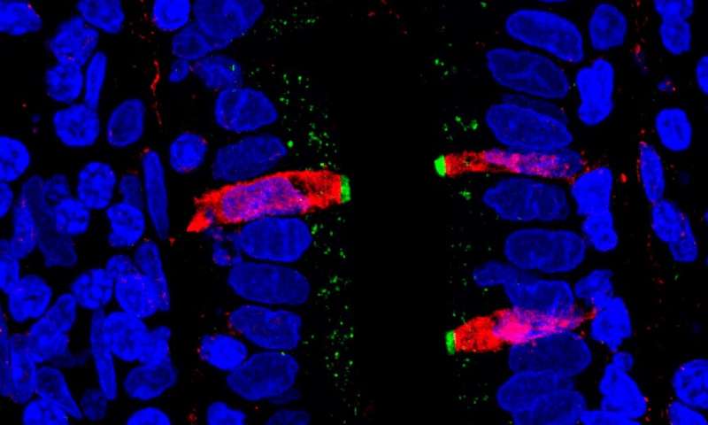 Scientists map entire human gut at single cell resolution