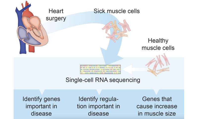 Sequencing of single RNA cells opens up new pathways in heart disease