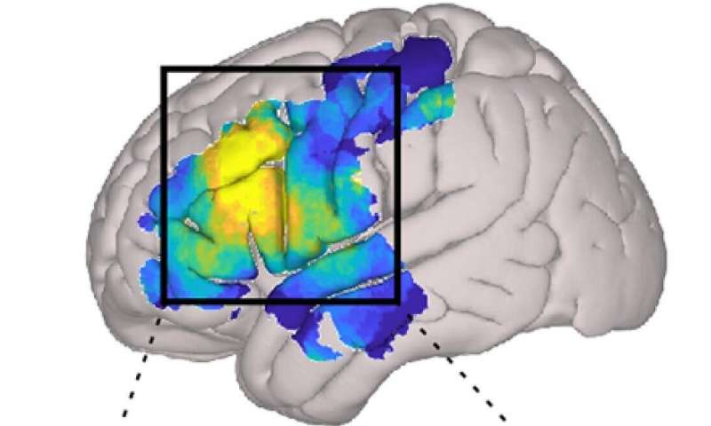 Study reveals brain networks enabling human conversation